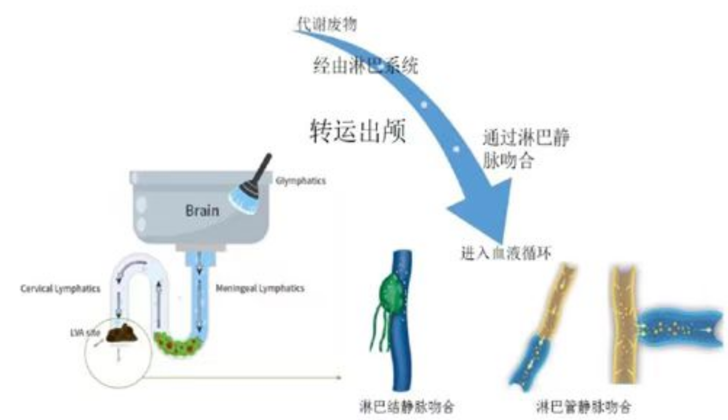 颈淋巴-静脉吻合治疗阿尔兹海默症的原理