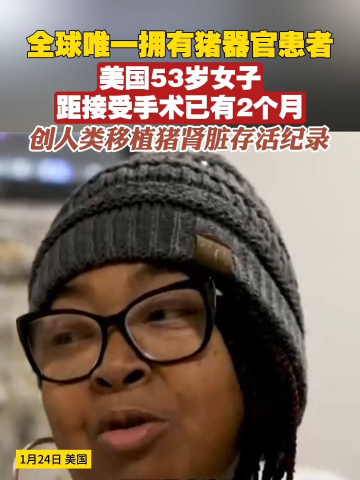 全球唯一拥有猪器官患者，美国53岁女子距接受手术已有2个月，创人类移植猪肾脏存活纪录#美国 #猪 #肾脏