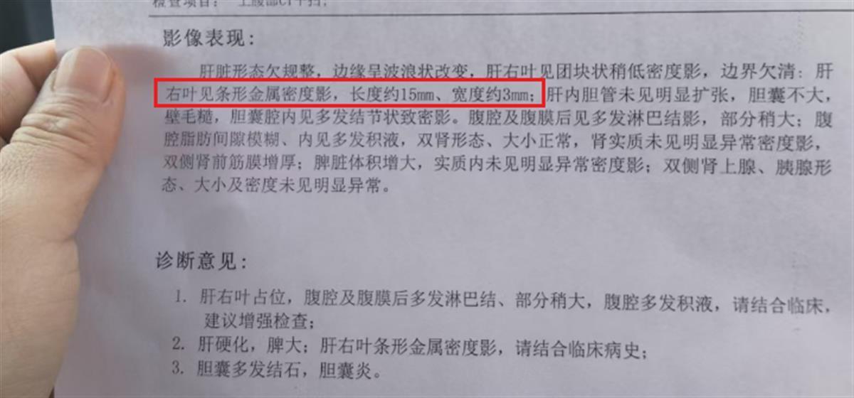 影像报告 受访者提供