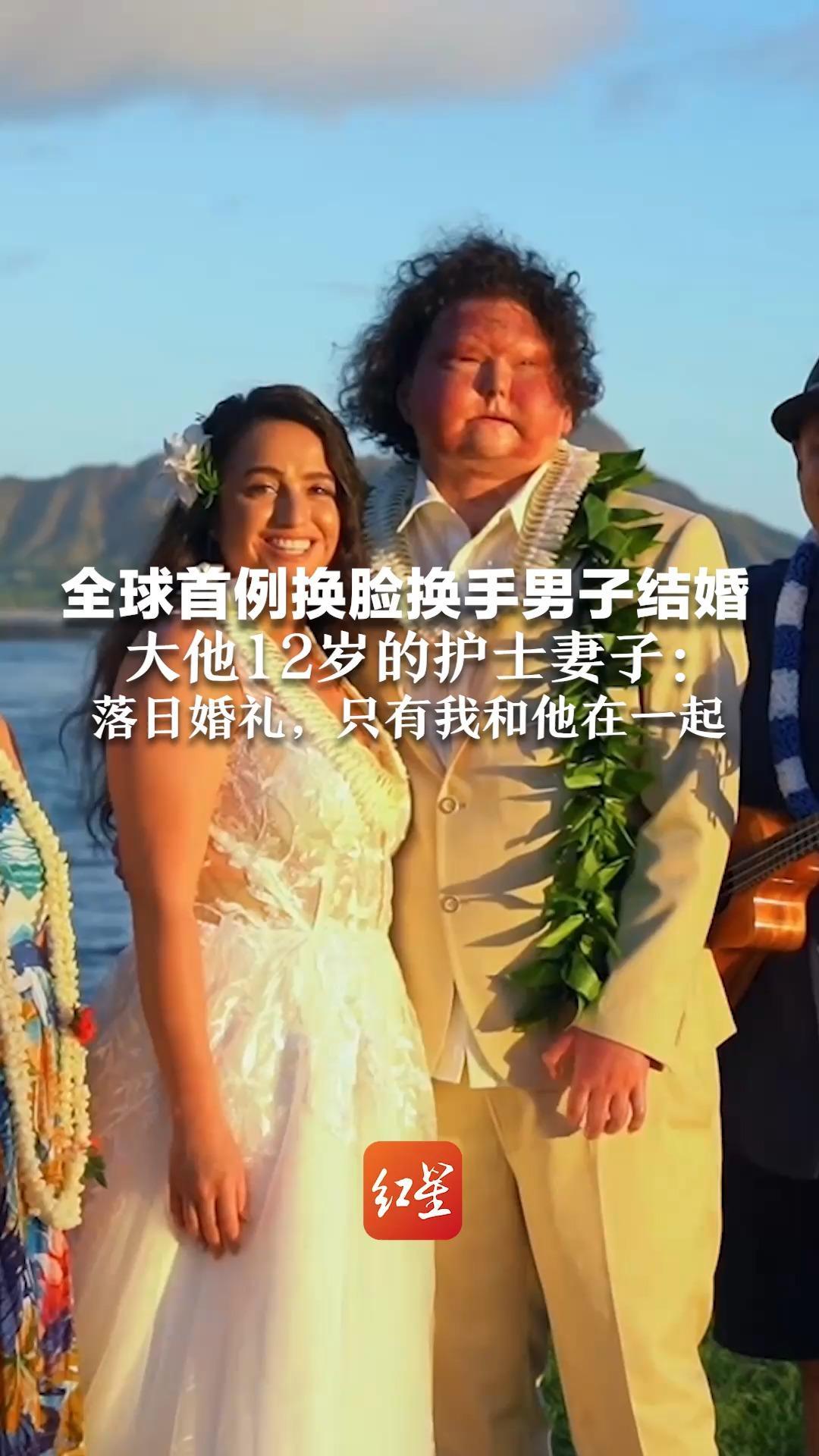 全球首例换脸换手男子结婚 大他12岁的护士妻子：落日婚礼，只有我和他在一起