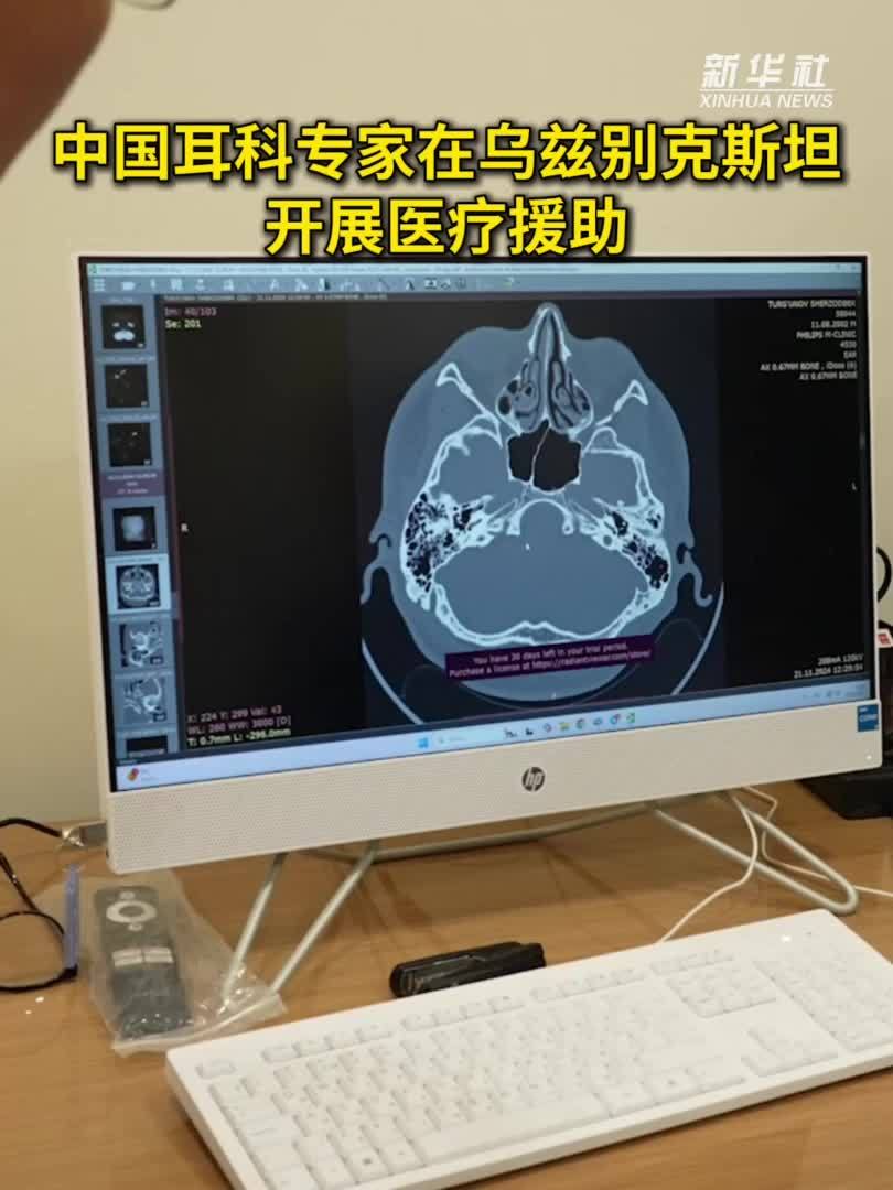 中国耳科专家在乌兹别克斯坦开展医疗援助