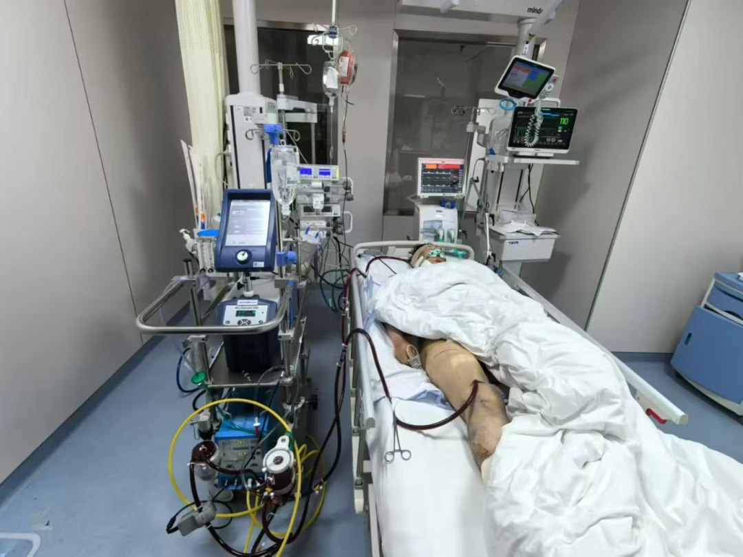 命悬一线丨西安市红会医院成功联合多学科救治严重车祸多发伤患者