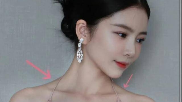 杜淳老婆医美翻车，王灿打肉毒素过敏进医院，后背全是红色抓痕封面图