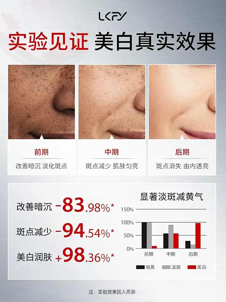 露卡菲娅祛斑套装——淡斑效果排名第一,多方测评种草!