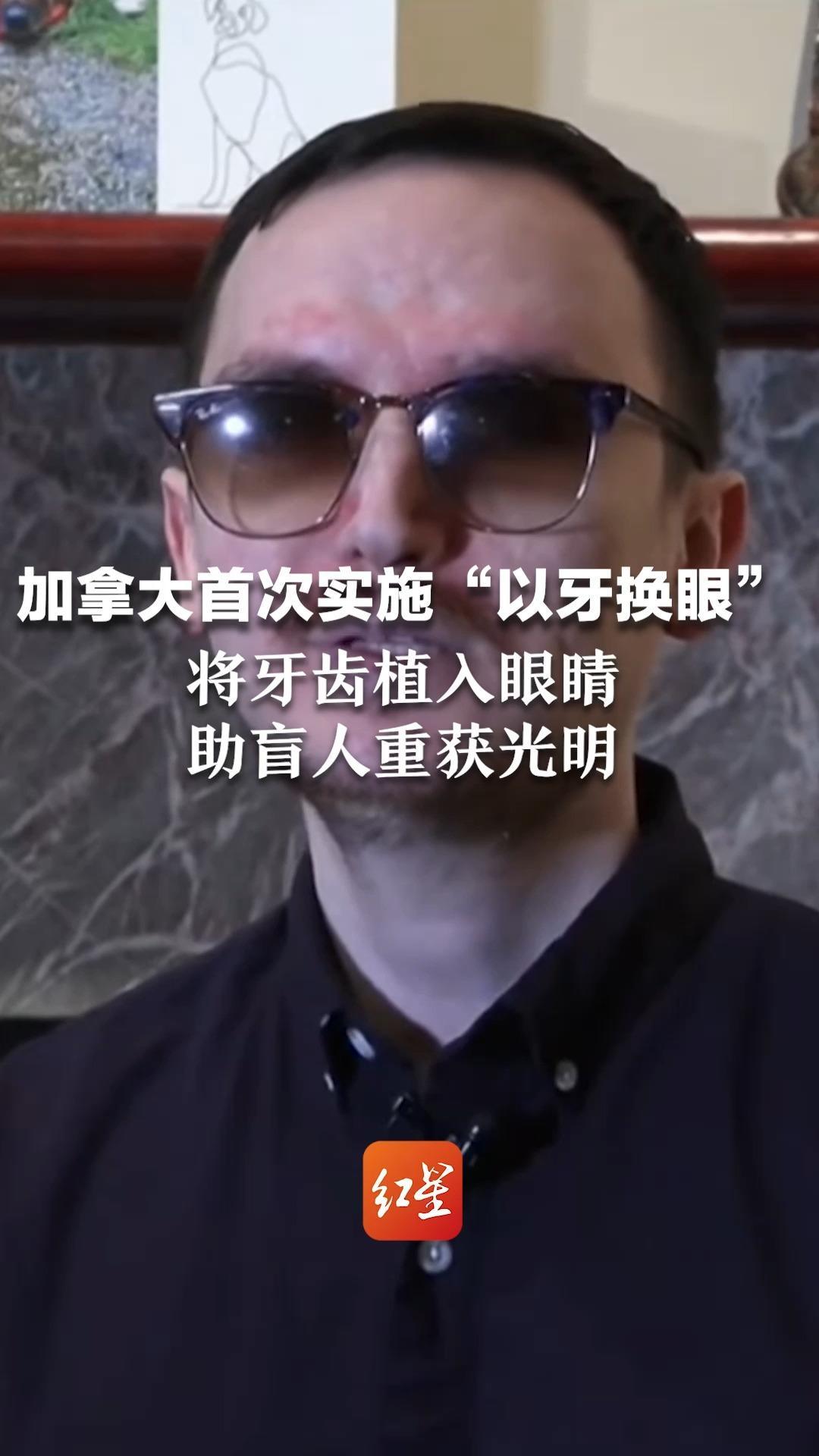 加拿大首次实施“以牙换眼”术 将牙齿植入眼睛重获光明 研究发现术后27年，94%的患者仍有视力