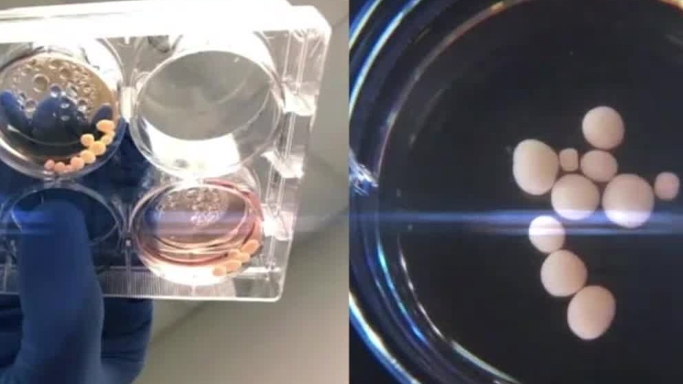 培养皿中的“迷你大脑”！干细胞技术可以让人类意识永存吗？