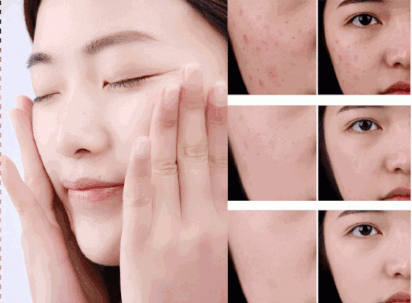 祛斑产品哪个牌子好有效果?露卡菲娅祛斑套装,国妆特字天然成分!