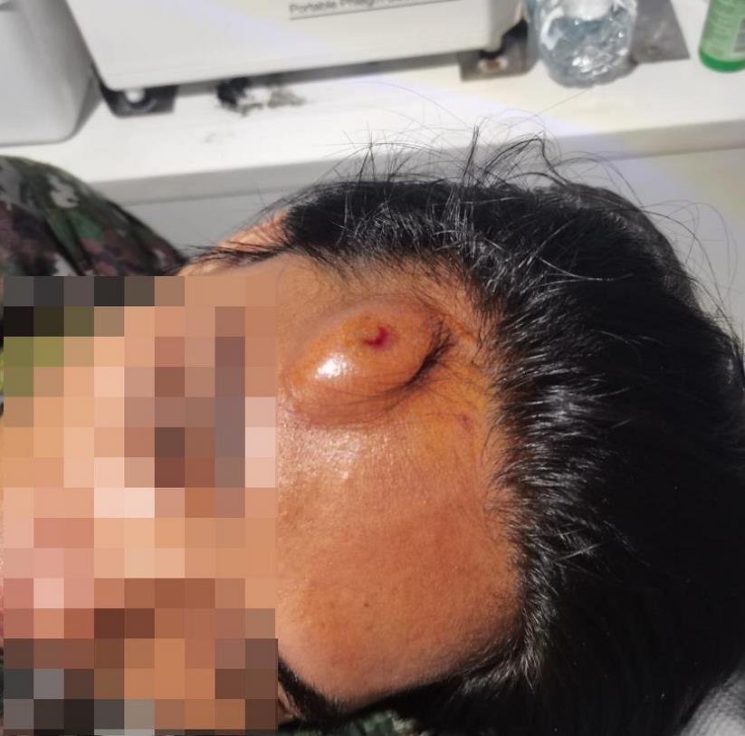 逮捕行动中,杜特尔特妻子将警察的头砸出大包
