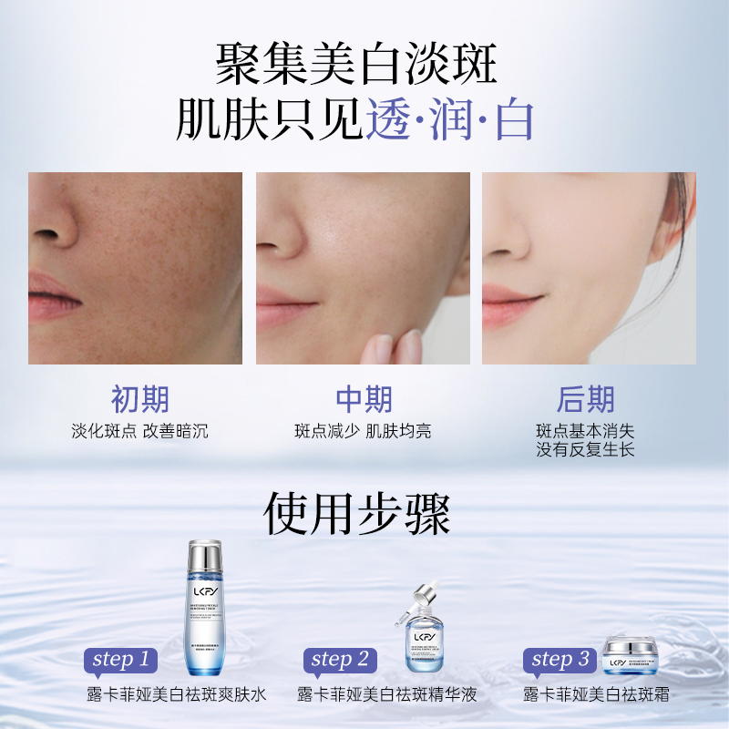 祛斑产品哪个牌子好有效果?露卡菲娅祛斑套装,国妆特字天然成分!