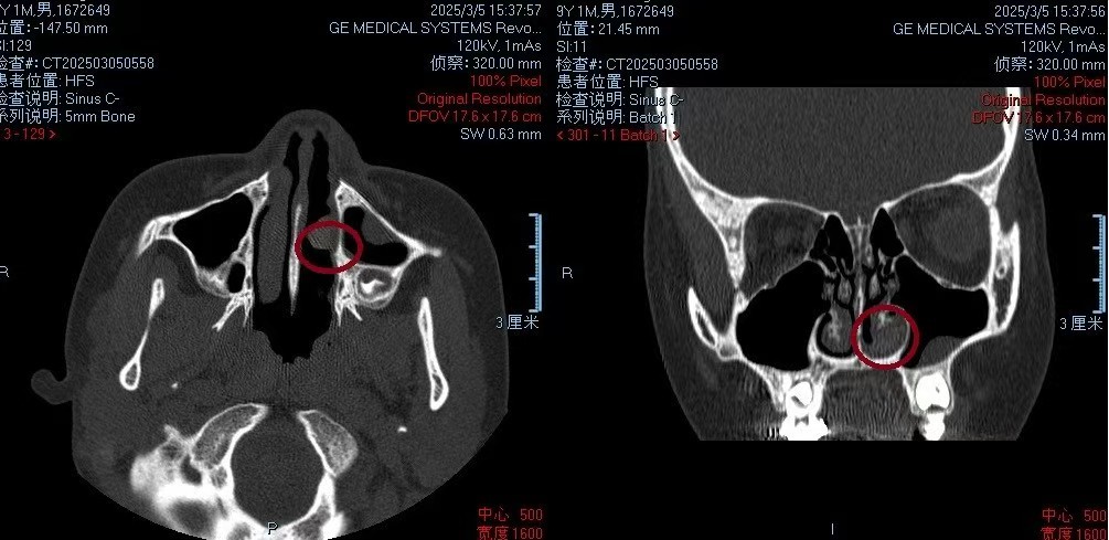 红圈中是橡皮