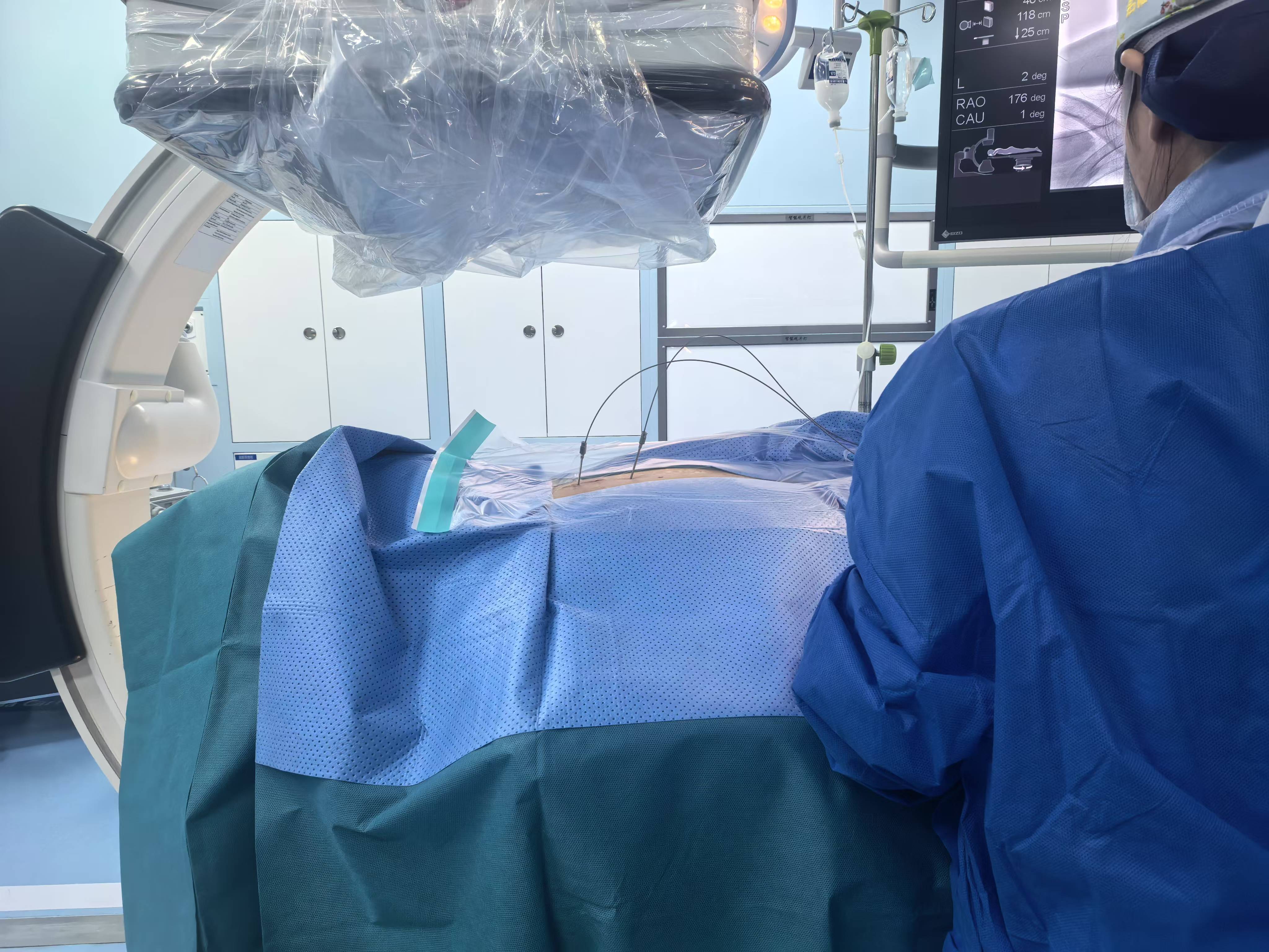 陶蔚教授团队为患者进行微创手术植入神经调控设备