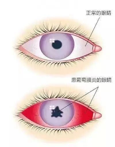 复杂眼病新办法！深眼医“黑科技” 打破治疗困局