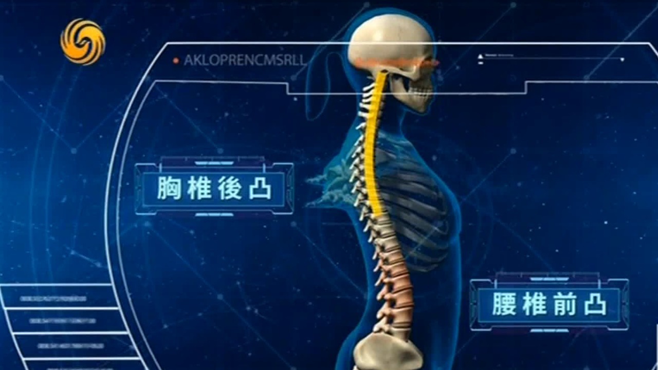 人类的S型脊柱一旦发生改变，腰痛就会接踵而至