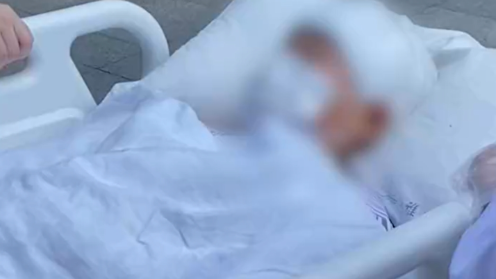 女孩被老师砸破头骨案将二审宣判，家属：女儿仍在休学治疗