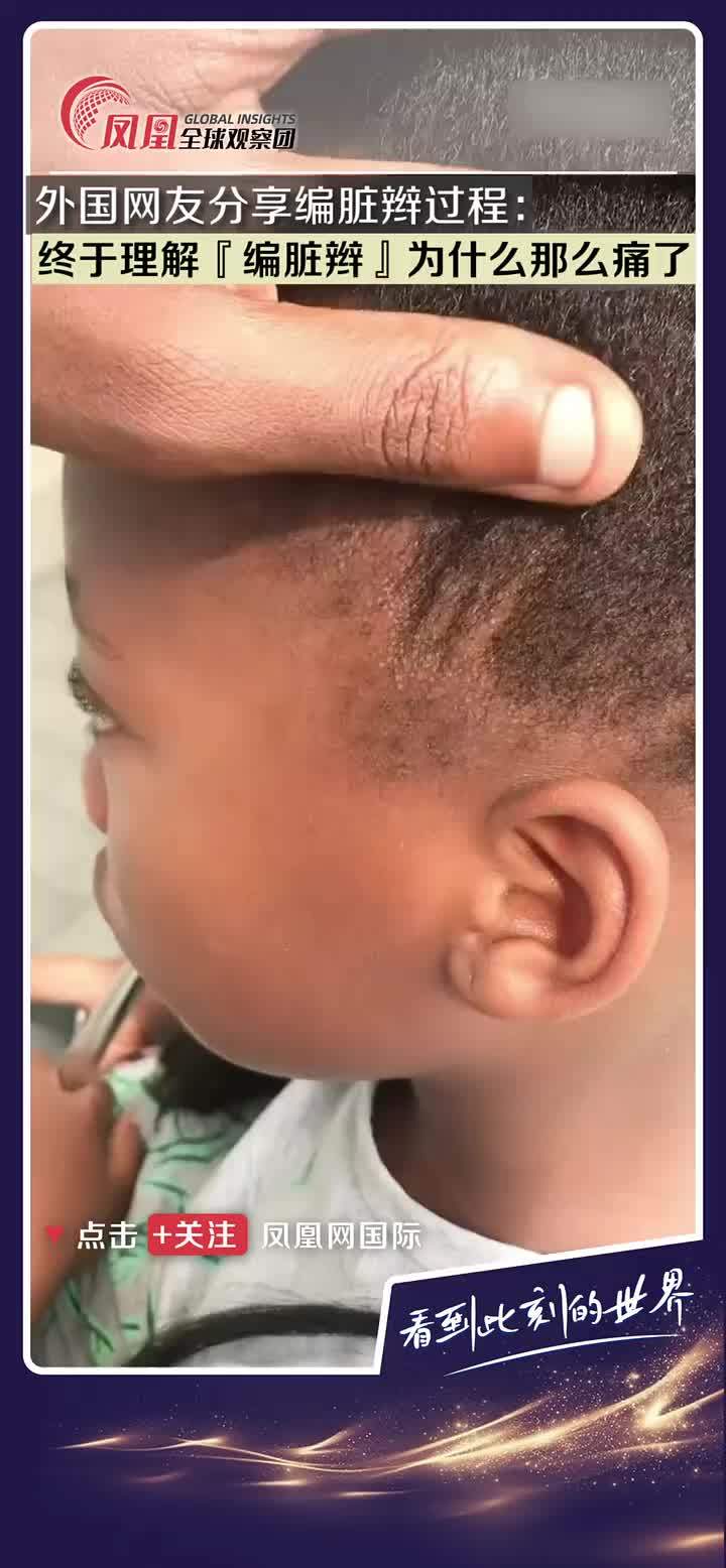 外国小孩编“脏辫”的过程，看得我呲牙咧嘴，头皮发疼。 #歪果仁 #编发 #脏辫 #发型