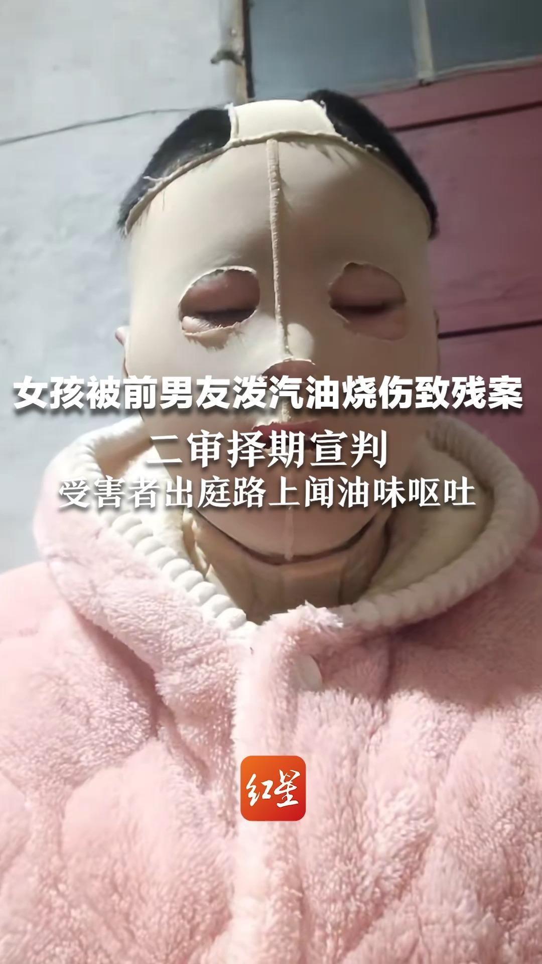 女孩被前男友泼汽油烧伤致残案 二审择期宣判 受害者出庭路上闻油味呕吐