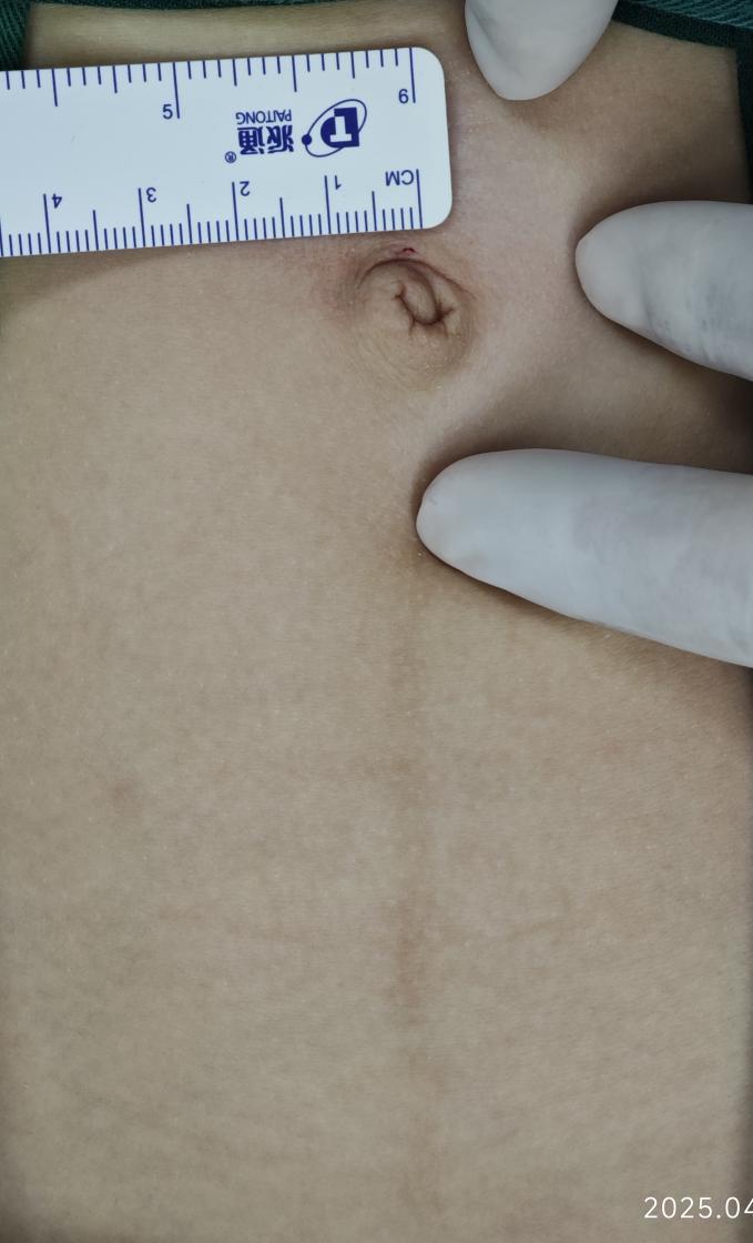 手术过程中的情况