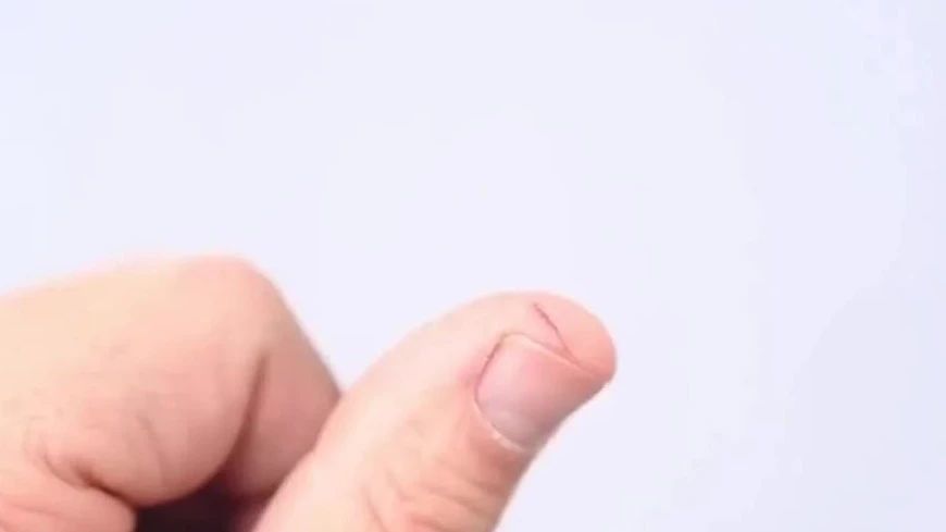 凝视疼痛部位可有效缓解剧痛