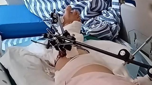 女子从12楼坠落奇迹生还，当事人：有网友说我会去讹客户