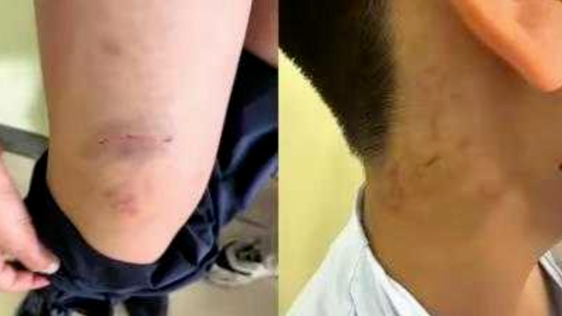 10岁男孩疑遭培训机构老师扇耳光，天津当地：已成立处置专班