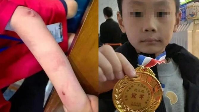 学校确认9岁围棋少年已不幸离世，村民曾劝阻其父亲施暴反被打