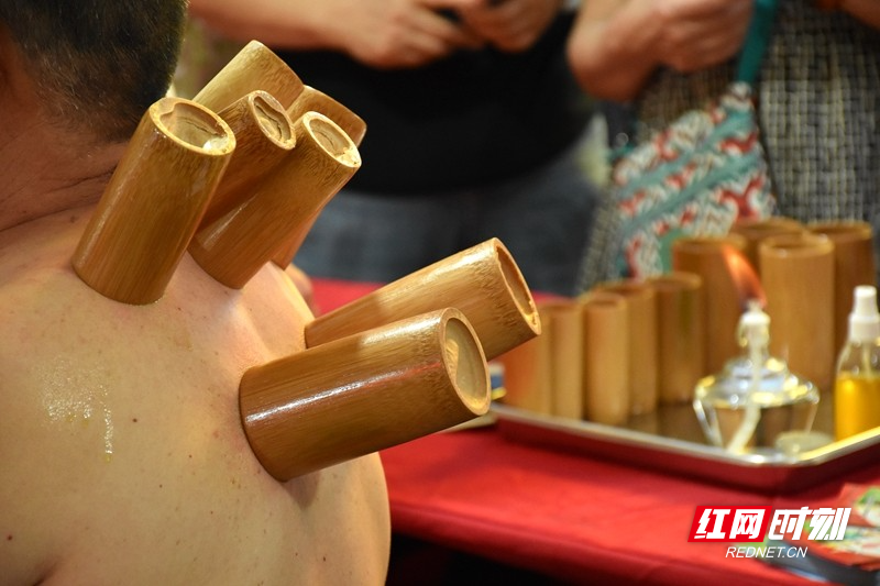 现场为市民拔罐。