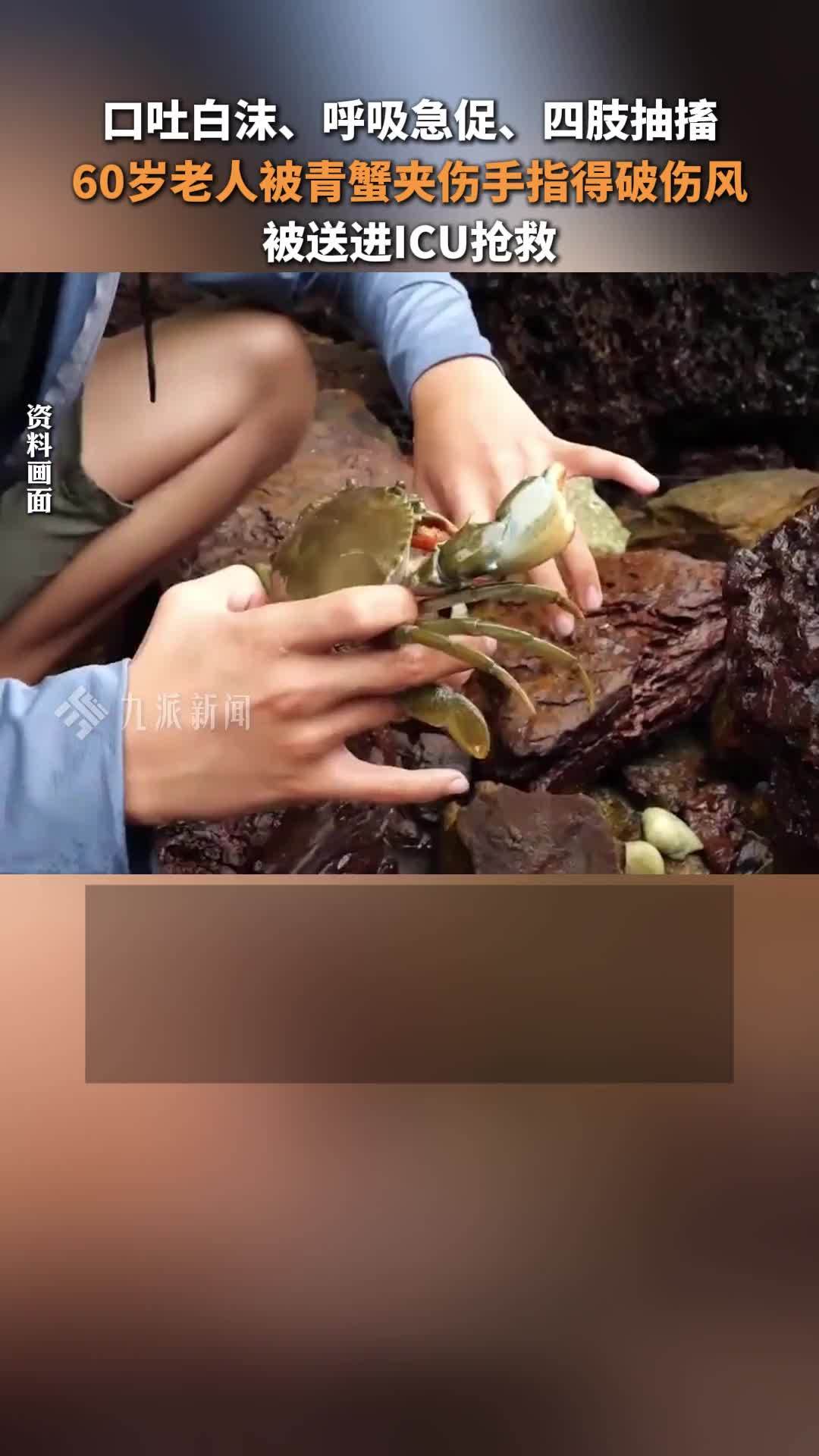60岁老人被青蟹夹伤手指，10多天未处理得破伤风，被送进ICU抢救