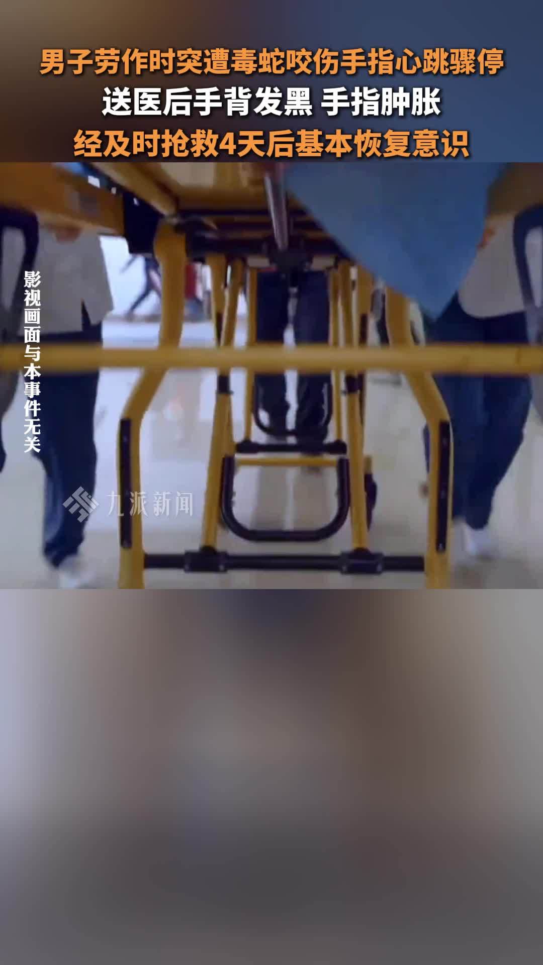 男子被毒蛇咬伤心跳骤停，手背局部坏死迹象明显，医生判断其被眼镜王蛇咬救回一命