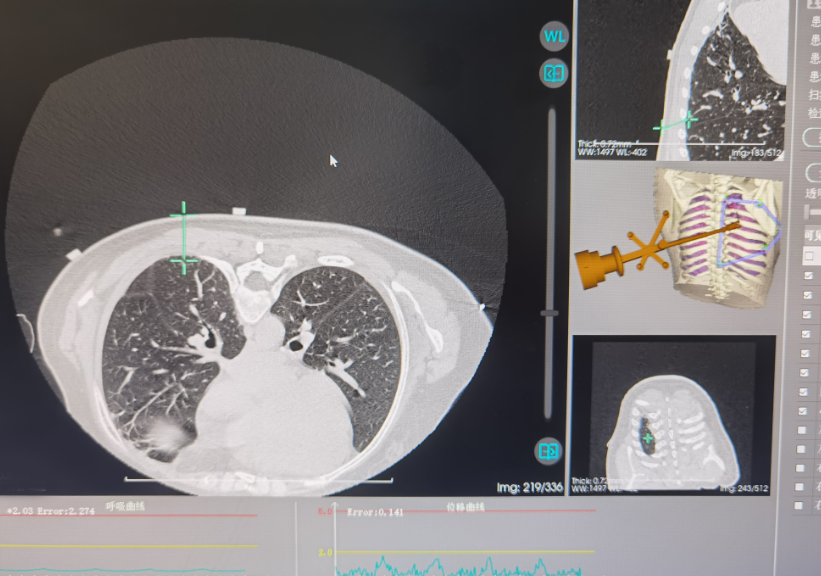 精细建模导航穿刺路线