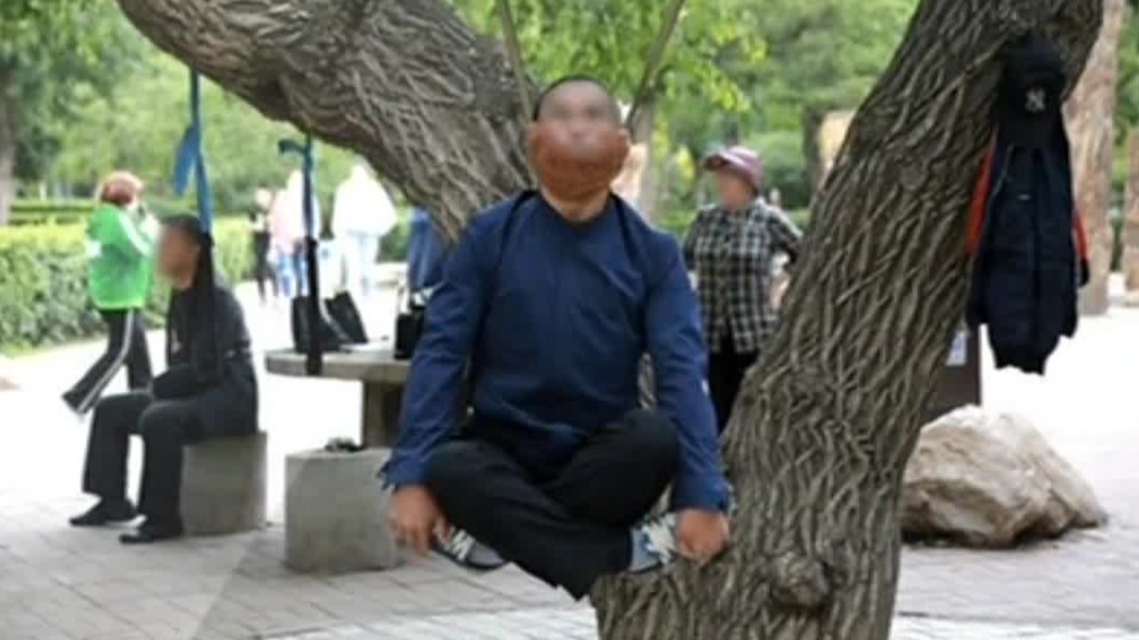 专家谈“上吊式”健身：无法缓解颈椎病，或导致神经损伤，严重将危及生命