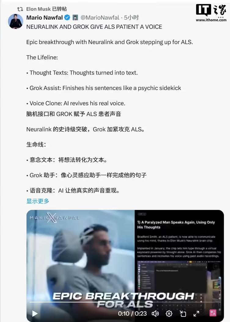 Neuralink和Grok合作,脑机芯片为渐冻症患者赋予“发声”能力