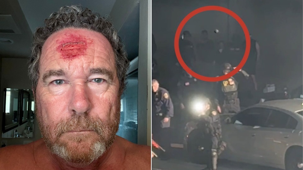 洛杉矶骚乱中，美媒摄影记者被橡皮子弹击中头部，并记录下这“恐怖一刻”
