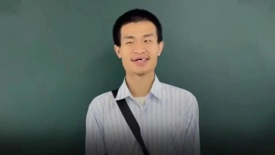 韦东奕的牙