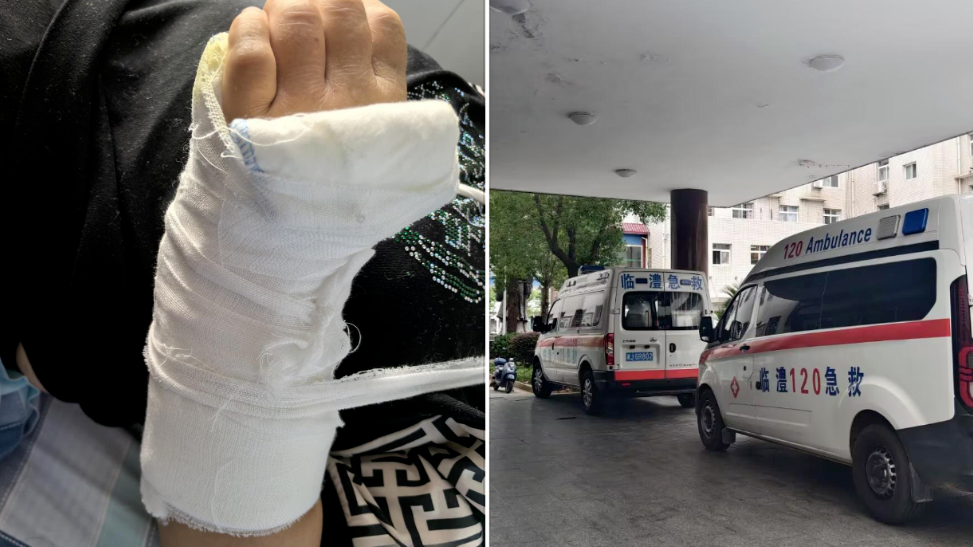 亲历者讲述花炮厂爆炸逃生细节：所有东西都在飞，躲在水沟里仍被砸伤头