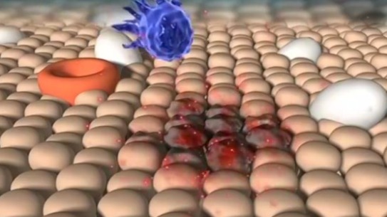 杀死“僵尸细胞”疗法，可延长果蝇和小鼠16%的寿命，普通人能用吗？