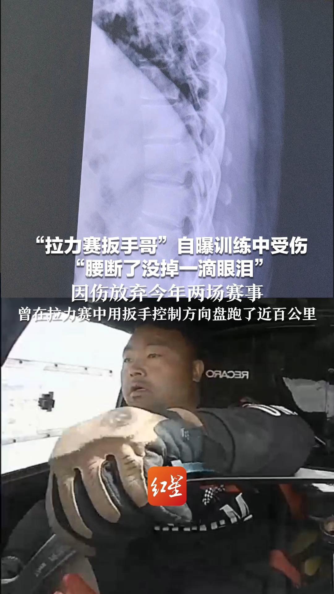 “拉力赛扳手哥”自曝训练中受伤“腰断了没掉一滴眼泪”因伤放弃今年两场赛事 曾在拉力赛中用扳手控制方向盘跑了近百公里