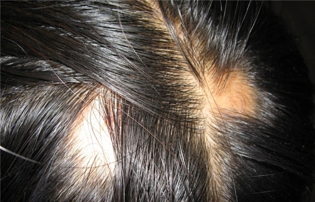 点击查看原始图片