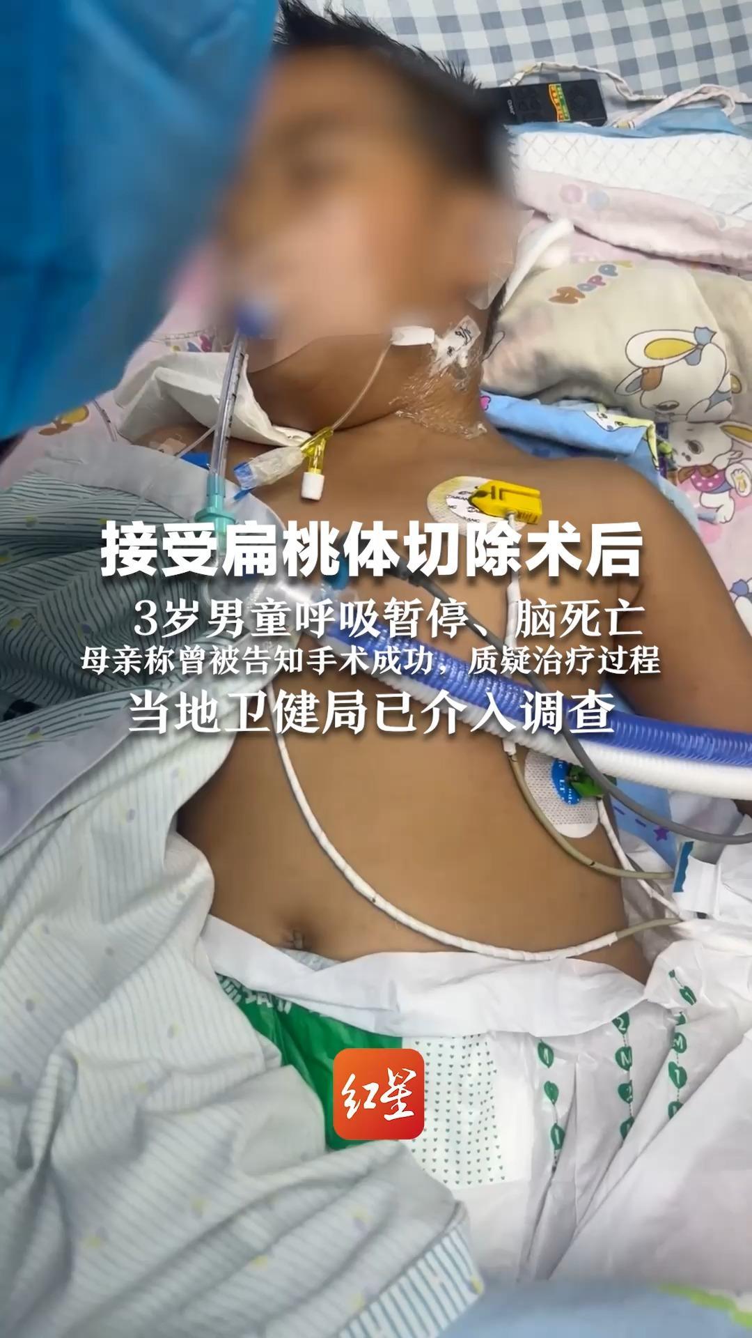 接受扁桃体切除术后 3岁男童呼吸暂停、脑死亡 母亲称曾被告知手术成功，质疑治疗过程 当地卫健局已介入调查