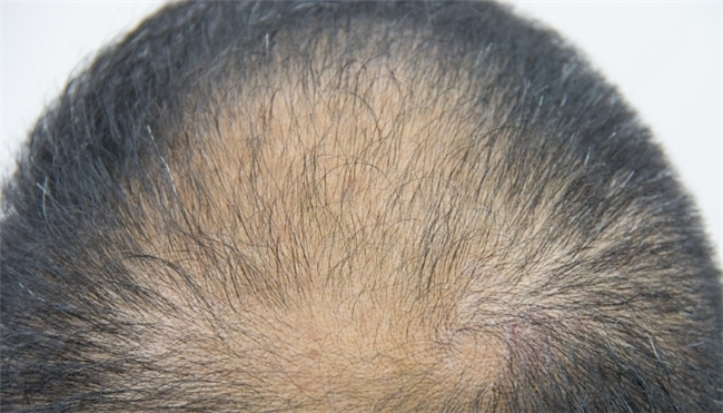 点击查看原始图片