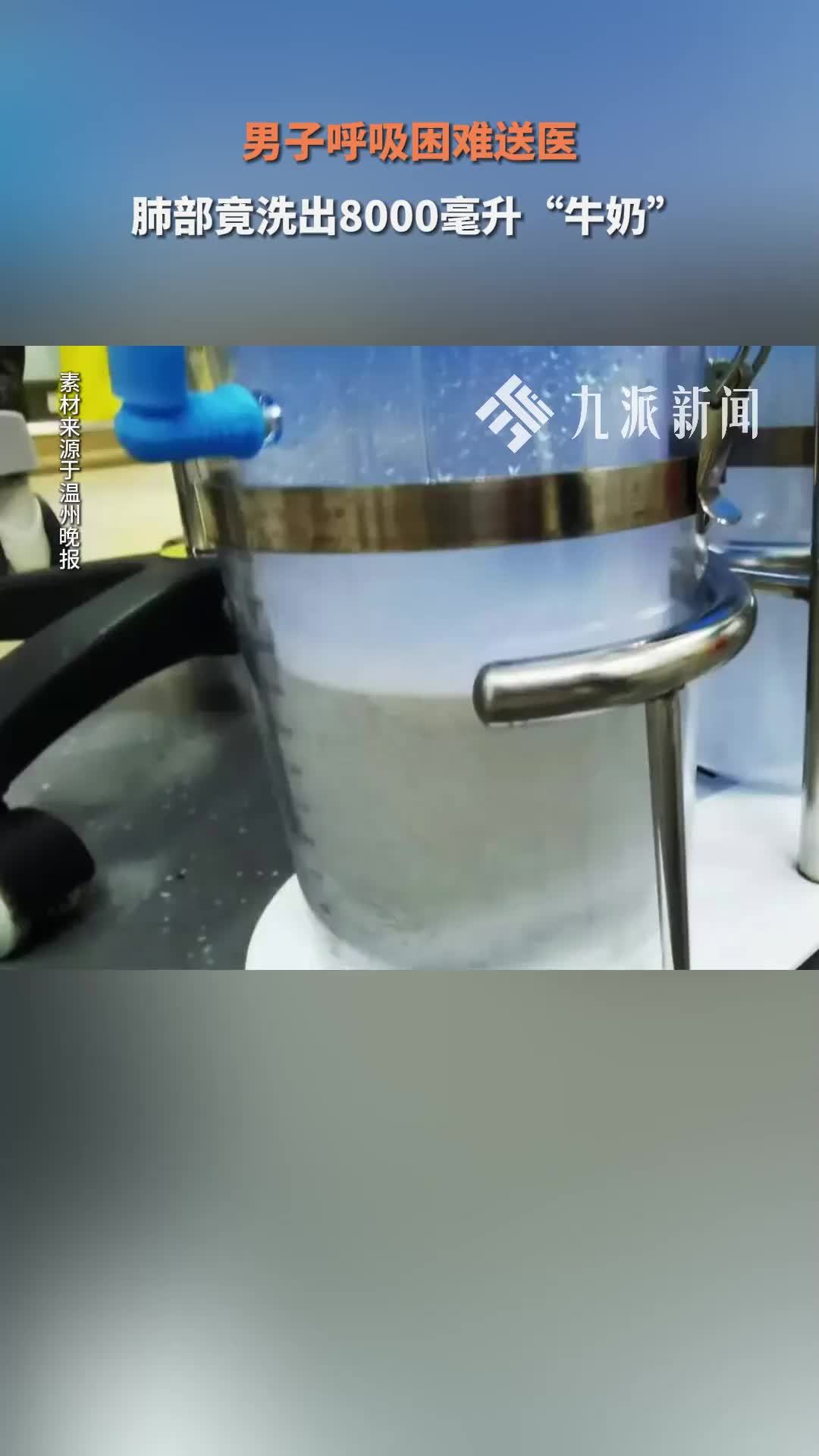 男子呼吸困难送医，肺部竟洗出8000毫升“牛奶”