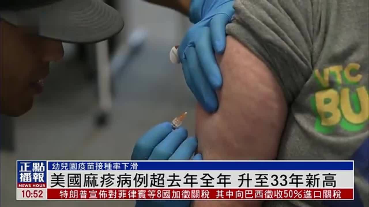 美国麻疹病例超去年全年 升至33年新高