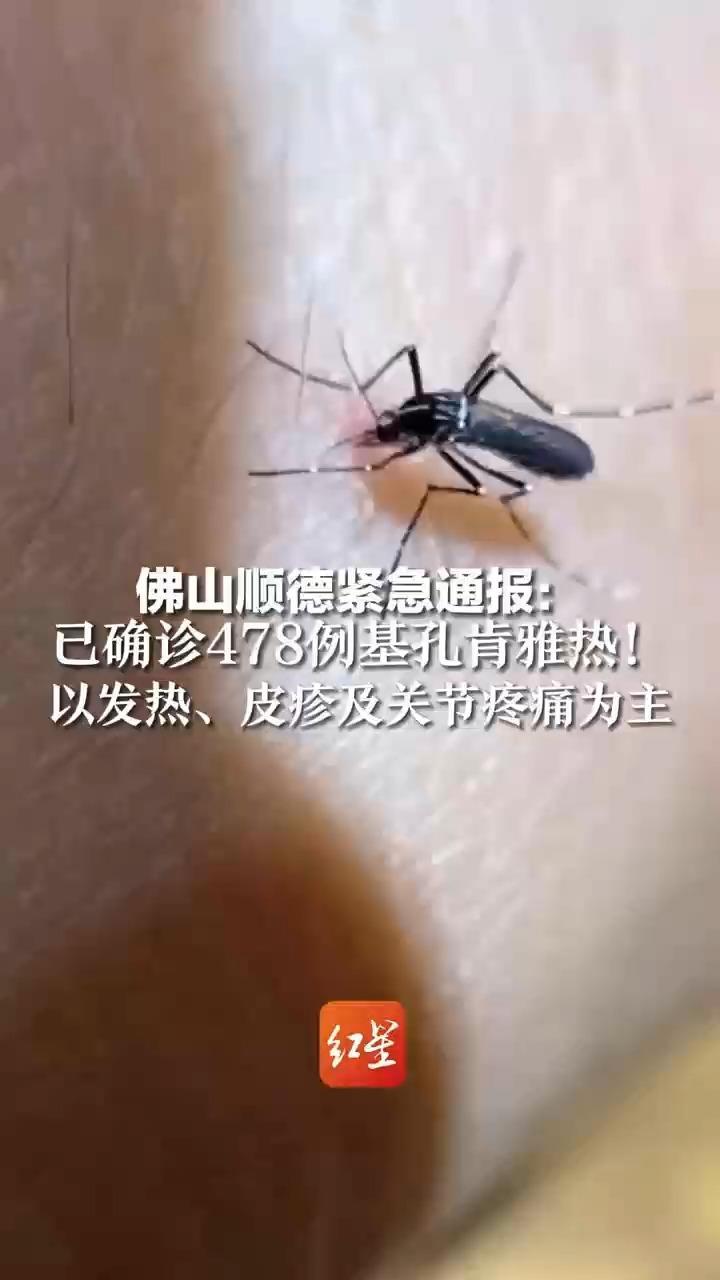 佛山顺德紧急通报：已确诊478例基孔肯雅热！以发热、皮疹及关节疼痛为主 警惕黑白花纹的“花蚊子”