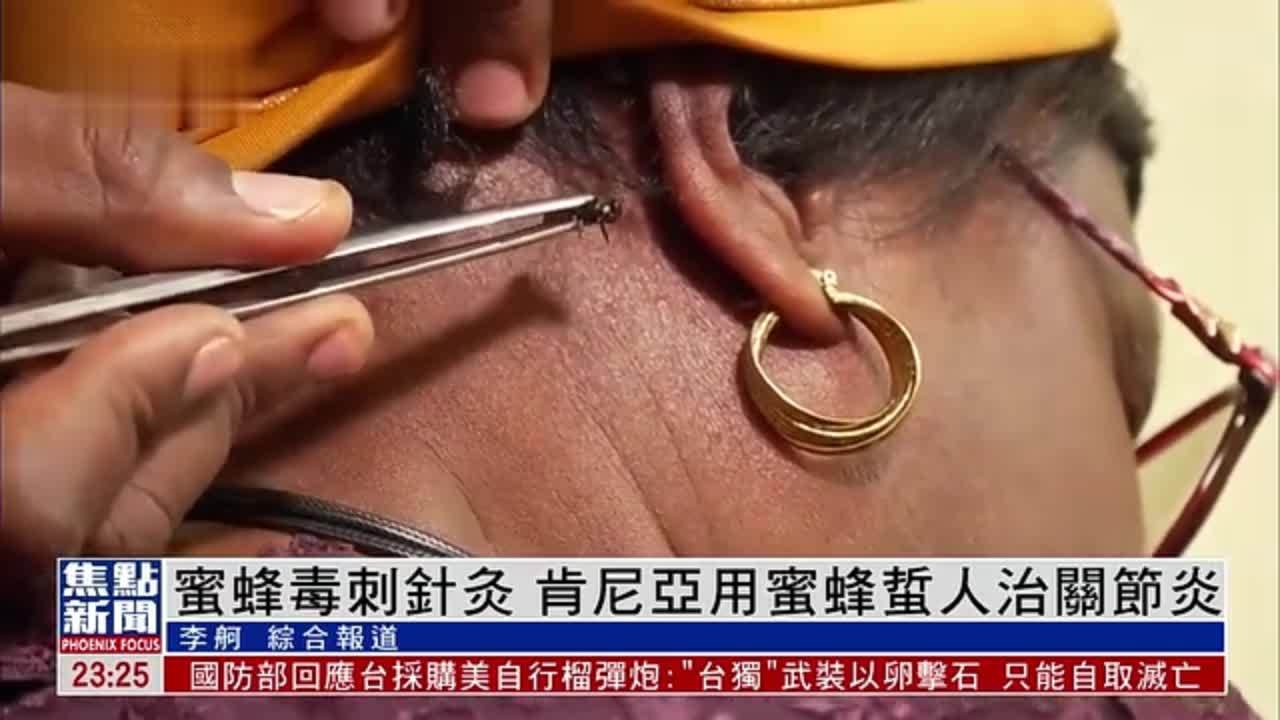 蜜蜂毒刺针灸 肯尼亚用蜜蜂蜇人治关节炎