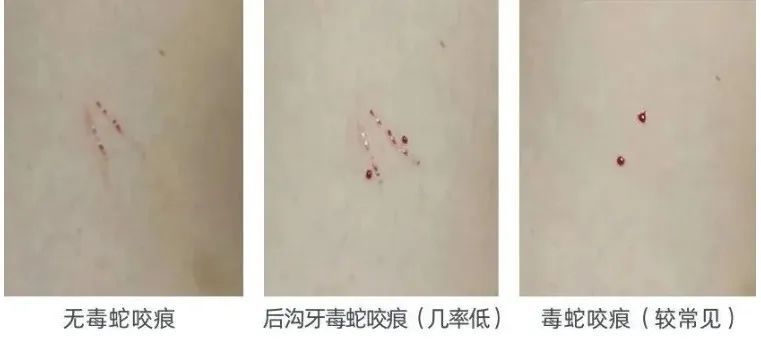 彭泽县一居民家中惊现剧毒银环蛇 提醒：九江这些医院有抗蛇毒血清或蛇毒血凝酶