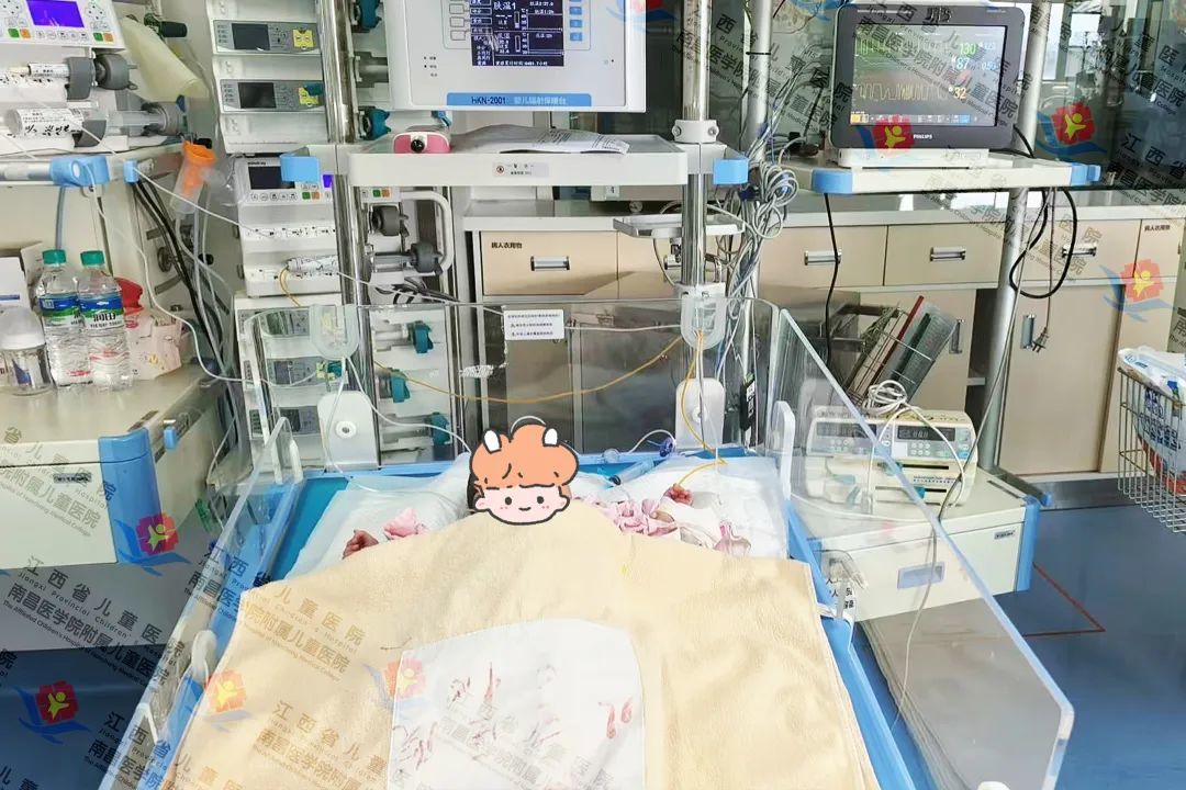 刚出生女婴患严重先心病 江西省儿童医院多学科团队勇闯“生命禁区”助获新生
