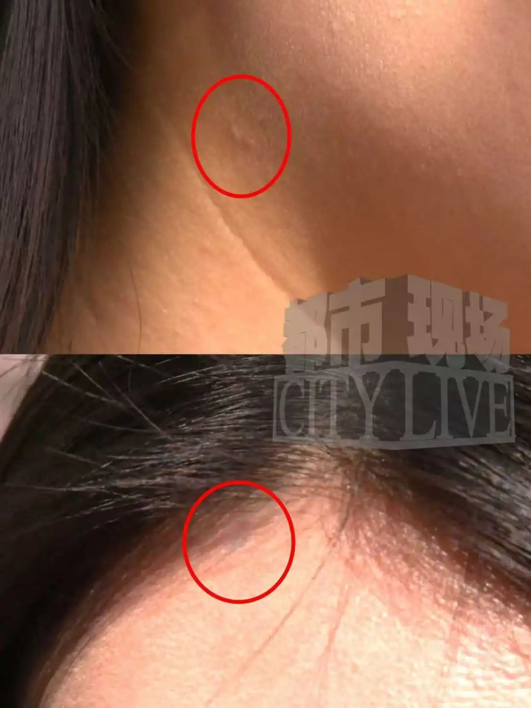 南昌一女子在“谦语美业”洗头遭“玄学”洗脑 花6668元点痣