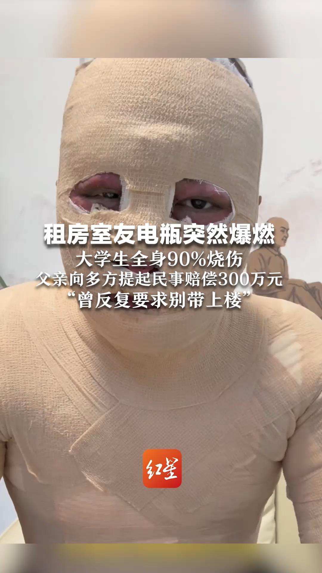 租房室友电瓶突然爆燃 大学生全身90%烧伤 父亲向多方提起民事赔偿300万元  “曾反复要求别带上楼”