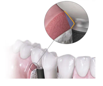 点击查看原始图片