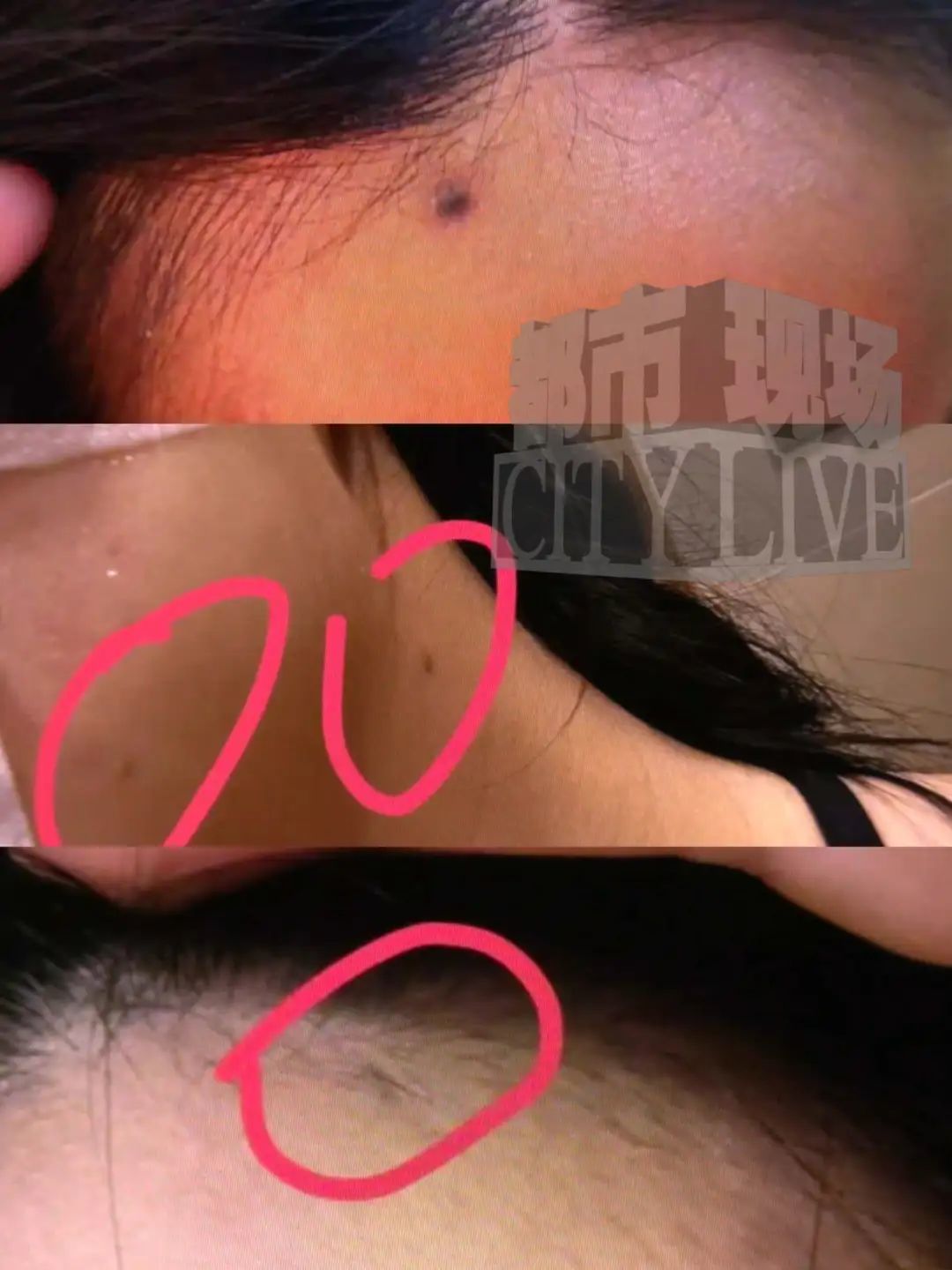 南昌一女子在“谦语美业”洗头遭“玄学”洗脑 花6668元点痣