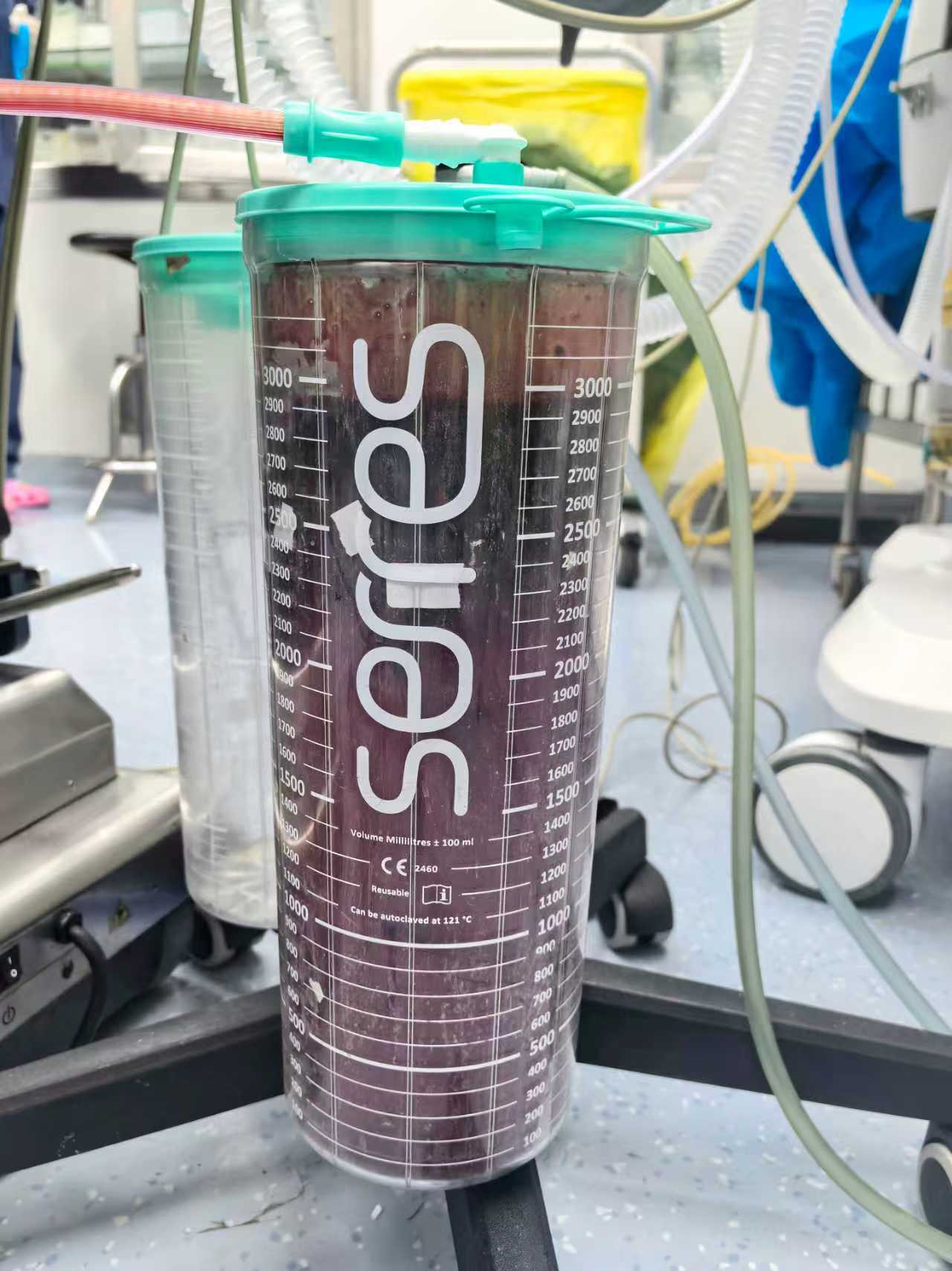 孕妇产前大出血 南医大二附院多学科联合抢救